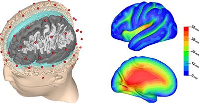 Global sensitivity of EEG source analysis to tissue conductivity uncertainties